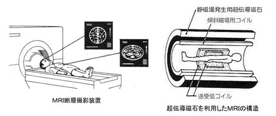 超伝導磁石の可能性と応用シリーズ-画像26